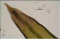 Orthotrichum_acuminatum3_apex_feuille_LT