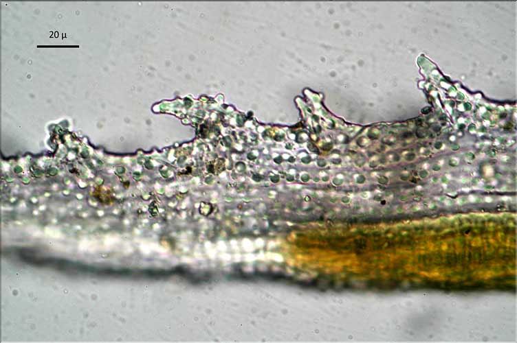 Racomitrium_lanuginosum6_base_pointehyaline_LT