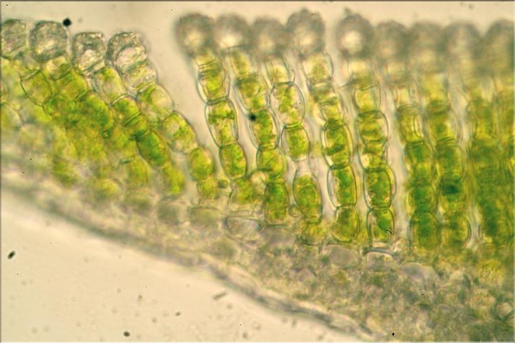 X_Pogonatum_urnigerum7_LT